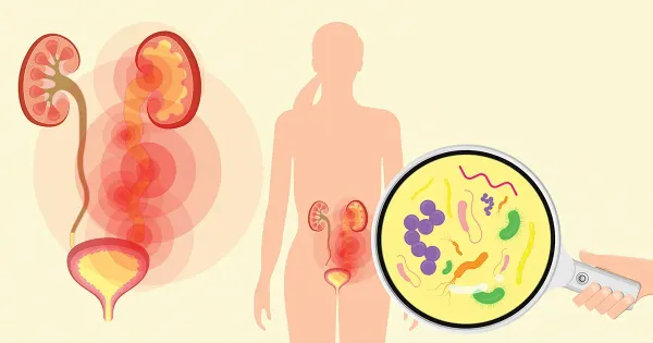 Quelles sont les principales causes et les complications potentielles des infections urinaires ?